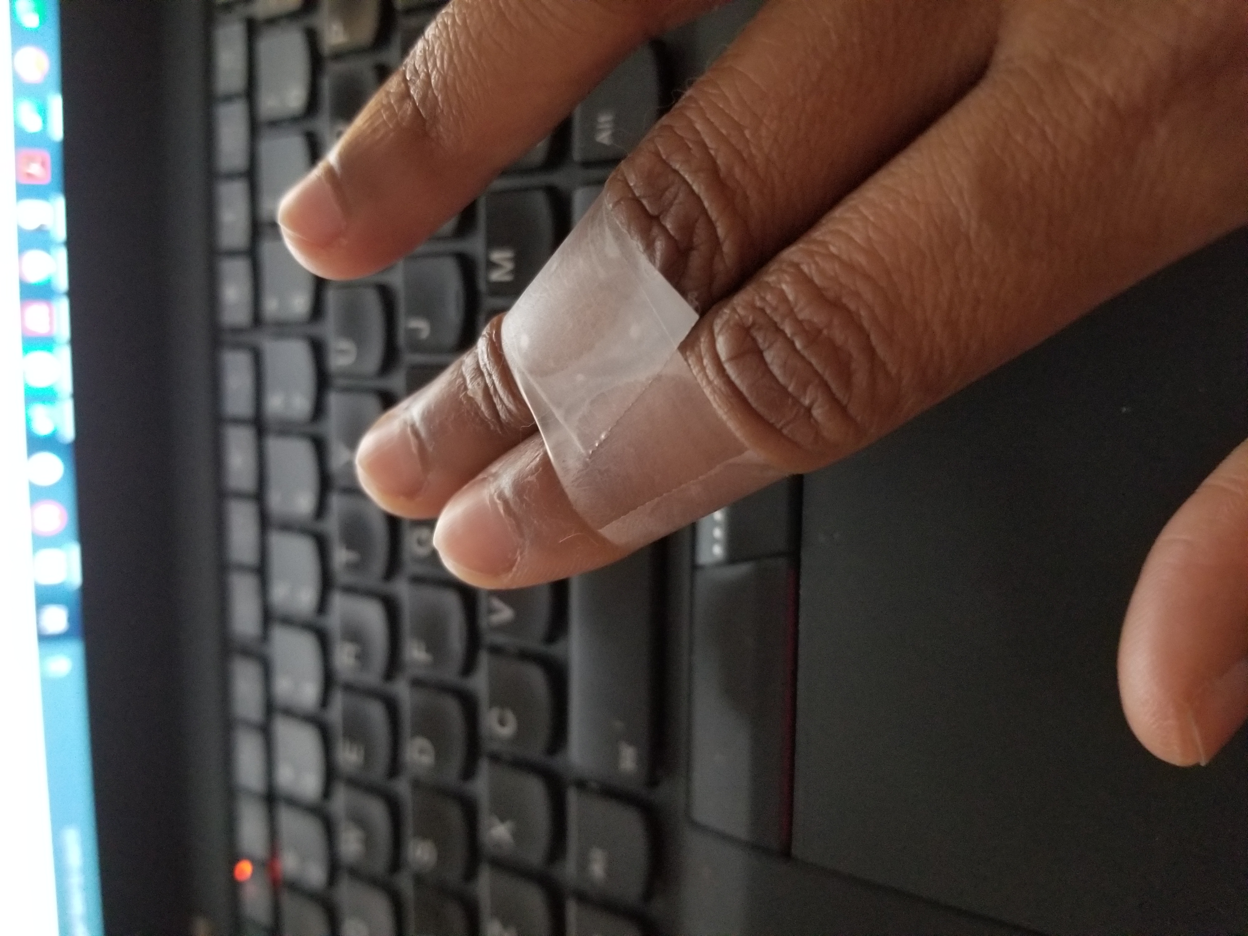 Two fingers splinted together with tape, held above a chiclet laptop keyboard.