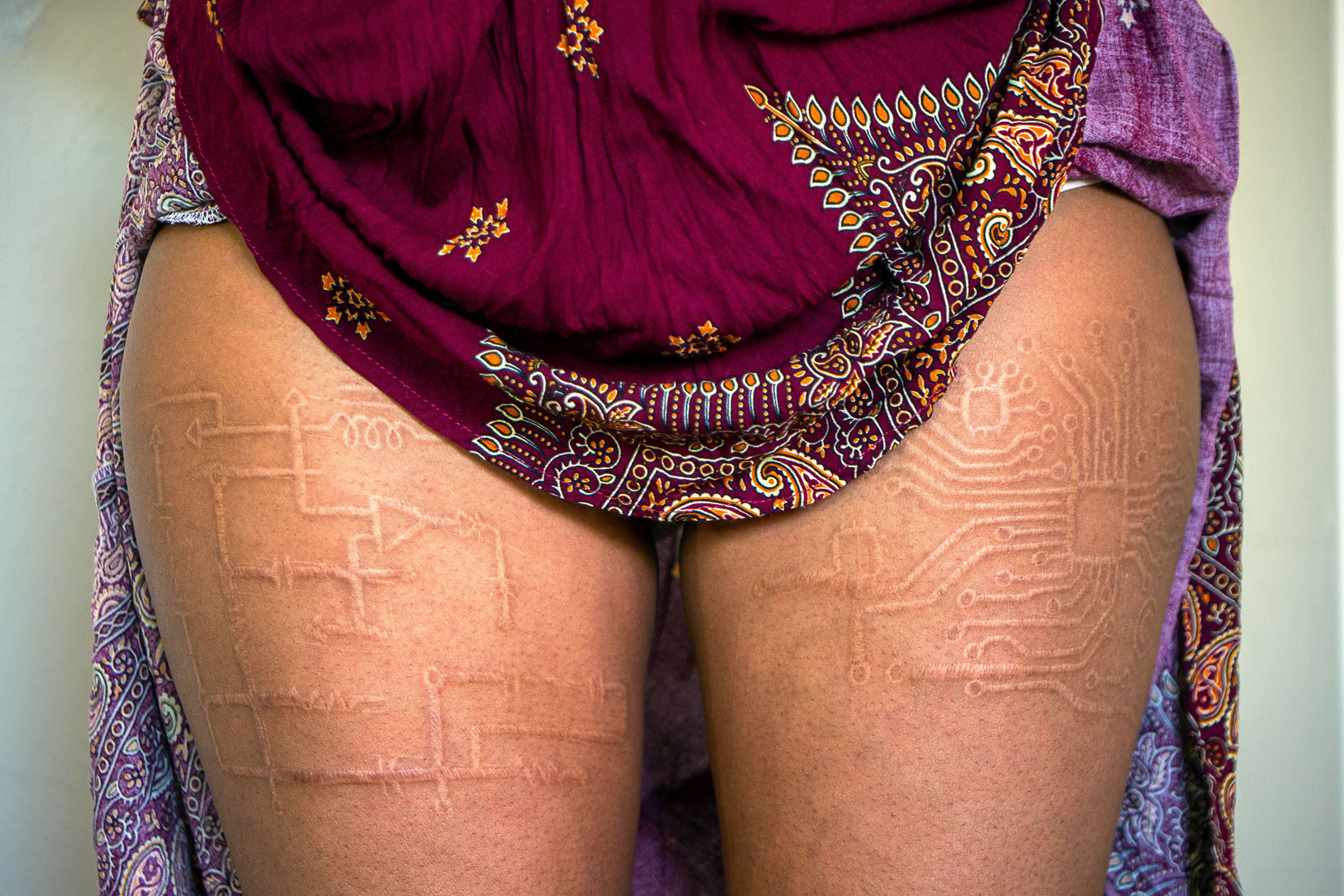 Thigh scarifications on brown skin.