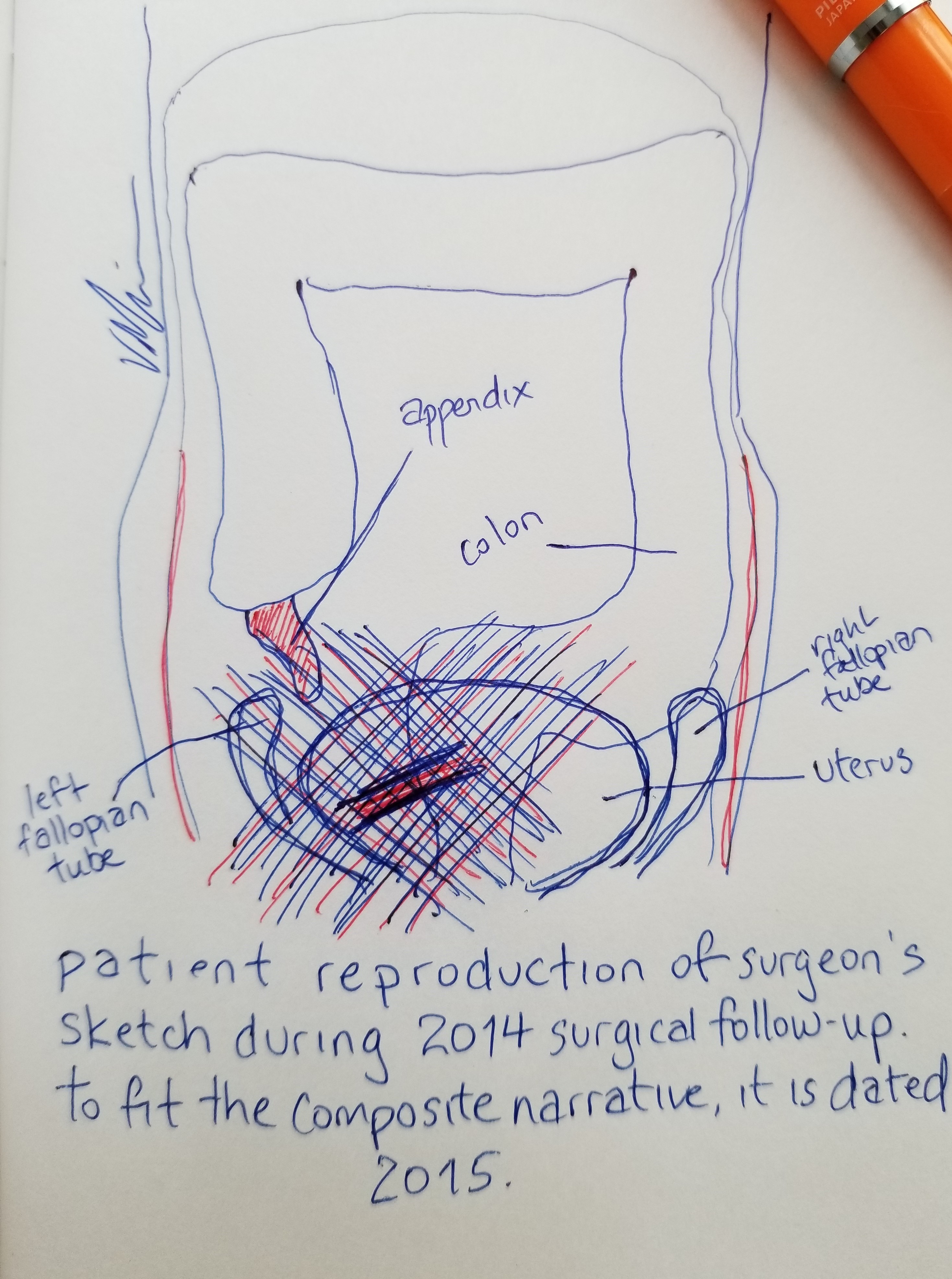 Abdomen, peritoneum, colon, appendix, uterus, and fallopian tubes in blue and red ink.