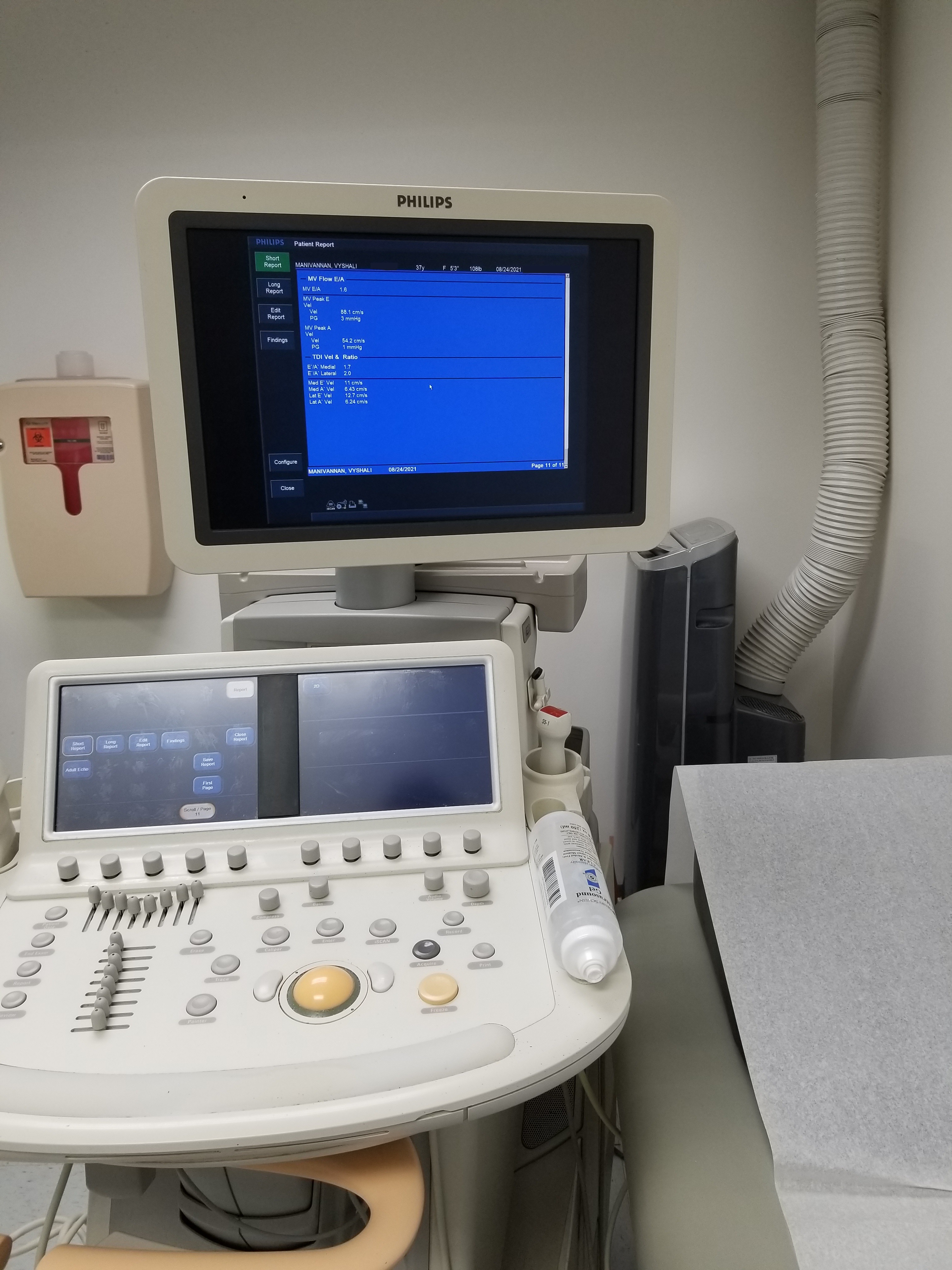 Echocardiography machine for a transthoracic echocardiogram.