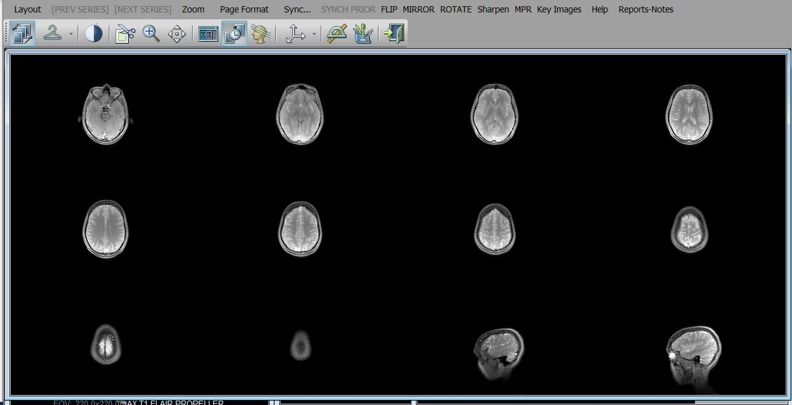 4x3 layout of brain MRI scans.