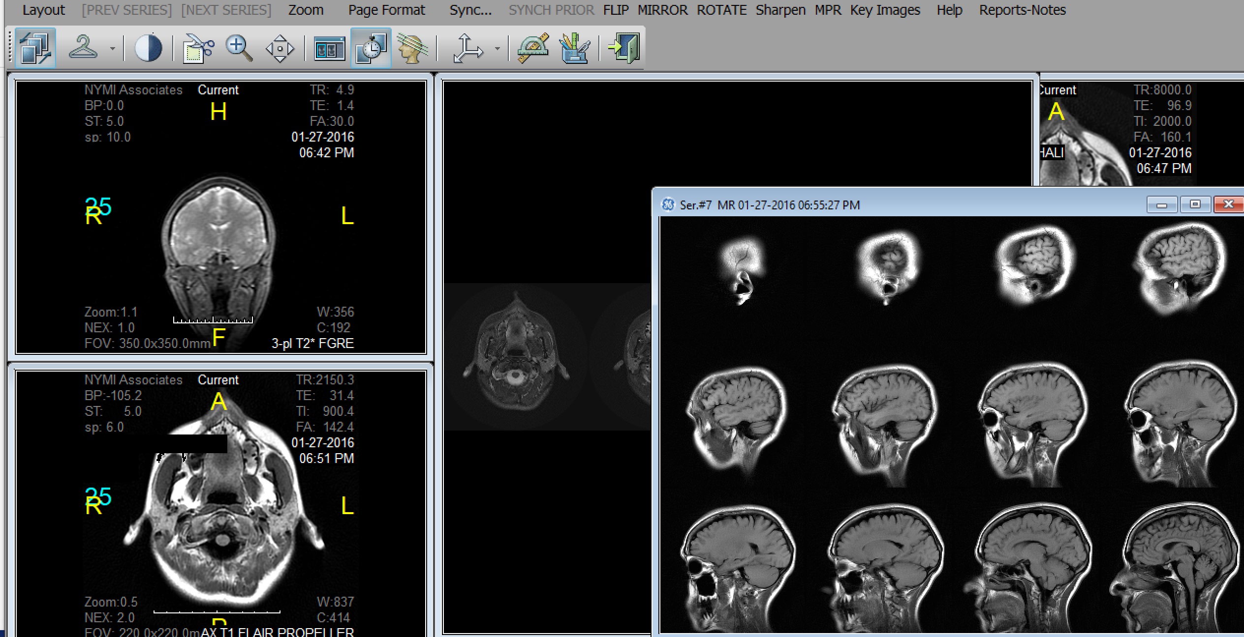 Scaffolded windows of brain MRIs in the DICOM viewer.