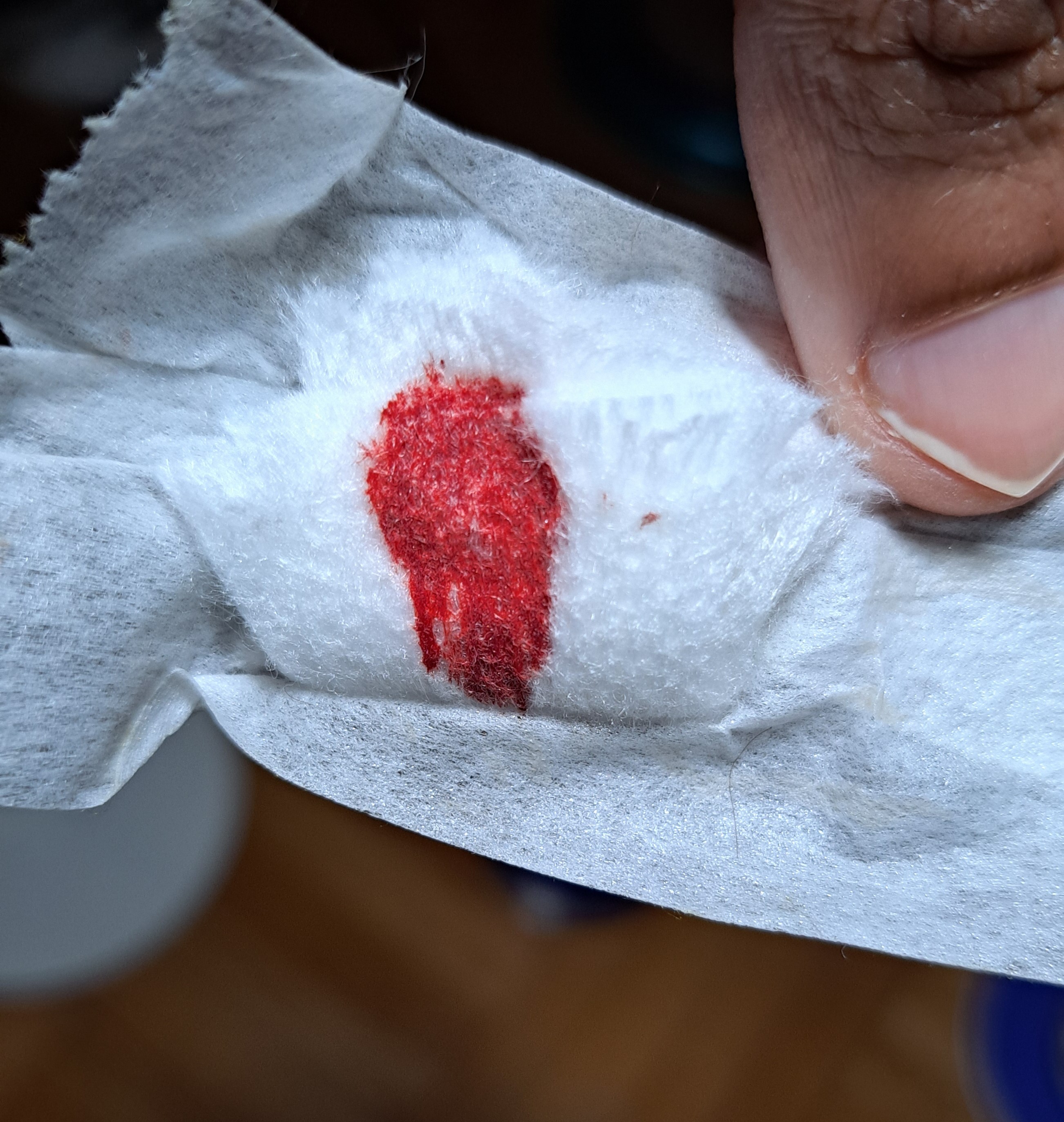 A bloodstained wad of cotton on a torn piece of tissue, held between brown fingers with pointed fingernails.